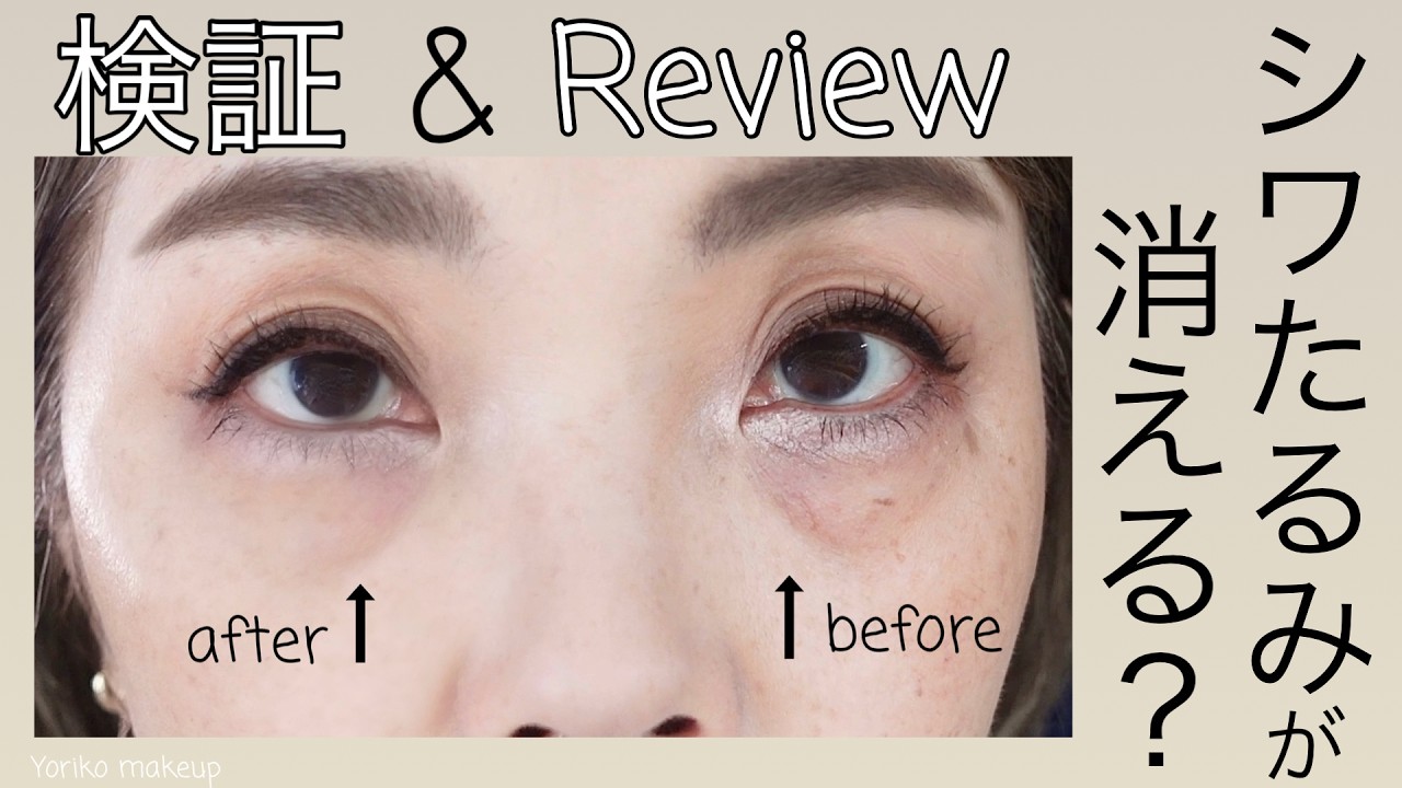 【辛口 検証＆レビュー】話題のクマ、しわ、たるみが消えるアイクリーム⁉️