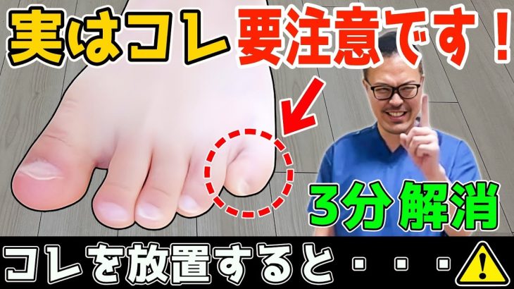 【これ放置してない？ 】 この寝指（内反小趾）3分で解消するだけで！(若返り｜お腹・足痩せ｜内臓脂肪・中性脂肪 減少｜頻尿・外反母趾・腰痛・膝痛・股関節痛 解消)