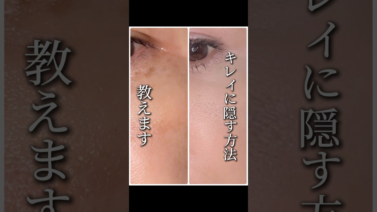 必見‼️シミだらけでも大丈夫🙆‍♀️こうすればキレイに消せる❤️