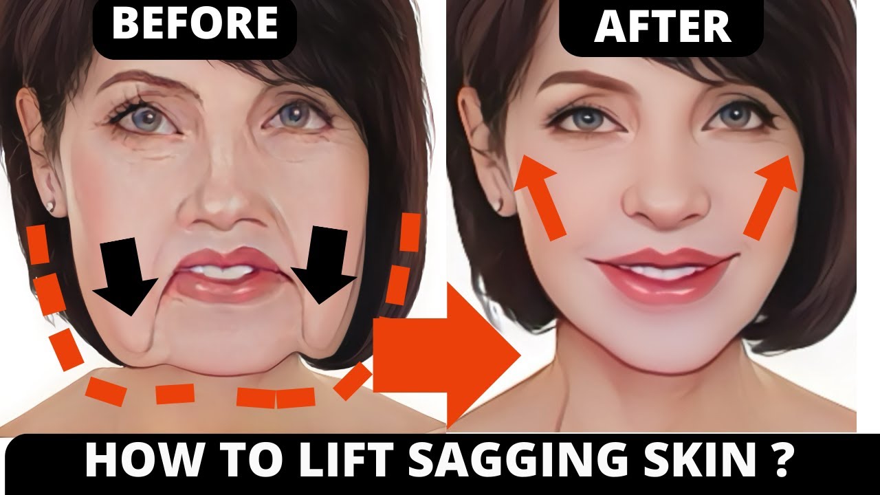 🛑 Anti-Aging Face Yoga for Sagging Skin, Jowls, Laugh Lines, and Forehead Wrinkles!
