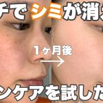【シミ】ガチでシミが消えるスキンケアを試した結果【ゼオスキン】by 桃桃