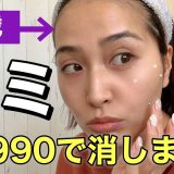 【必見】シミ消しには高濃度ハイドロキノン！40代でも遅くないコスパ良しスキンケア【ランテルノ】