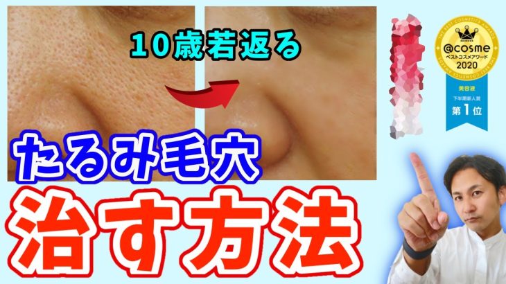 【プロが教える】老け顔の原因である頬の『たるみ毛穴』を撲滅する方法