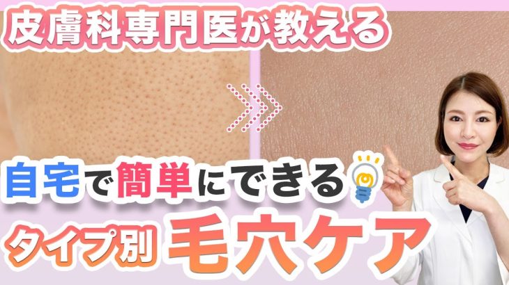 自宅でできる毛穴ケア！いちご鼻・黒ずみ・開き・たるみ毛穴の改善＆予防方法【皮膚科専門医が解説】