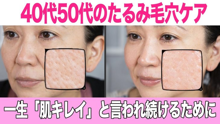プロが教える40代からの【たるみ毛穴ケア】髪も肌も美しく週末“ご自愛タイム”