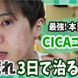 【肌荒れ 3日で治す】最強! 本当に効くおすすめCICAコスメはコレだぁ!!
