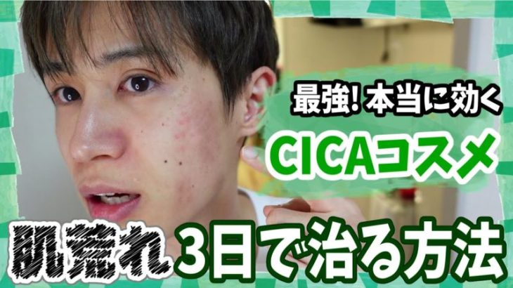 【肌荒れ 3日で治す】最強! 本当に効くおすすめCICAコスメはコレだぁ!!