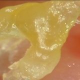 👃#82 Pull Out Blackheads Close up 200X – Blackheads Removal | ピンセットで角栓を抜く(HQ200倍)