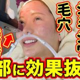 【肌質改善】毛穴、たるみ、シミやシワも改善できる最新美容機器を体験してきた！【美容整形・整形】