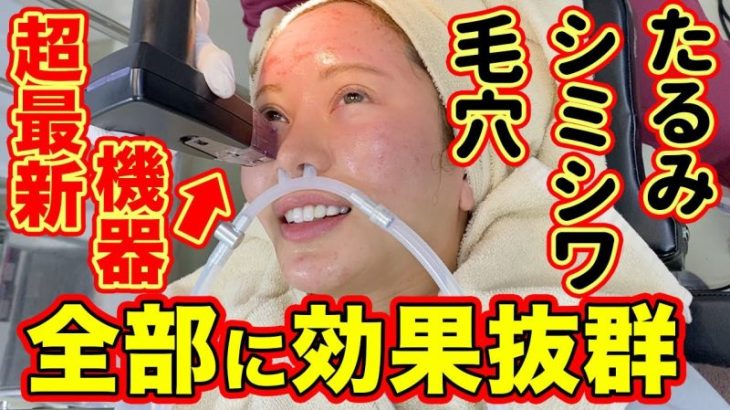 【肌質改善】毛穴、たるみ、シミやシワも改善できる最新美容機器を体験してきた！【美容整形・整形】