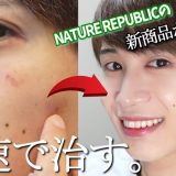 【毛穴・肌荒れ人必見】新商品キター！ 肌荒れ時のナイトスキンケア方法！