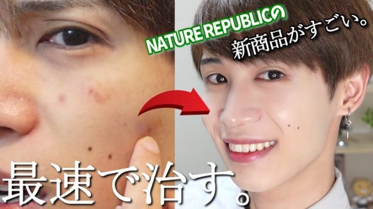 【毛穴・肌荒れ人必見】新商品キター！ 肌荒れ時のナイトスキンケア方法！