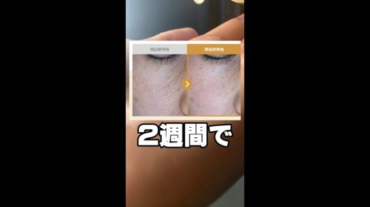 これ毛穴なくなるってやつ。ナンバーズイン