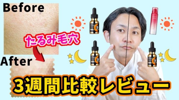 【たるみ毛穴】半顔ずつで美容液を変え撲滅できるか検証したら衝撃の結末が…。
