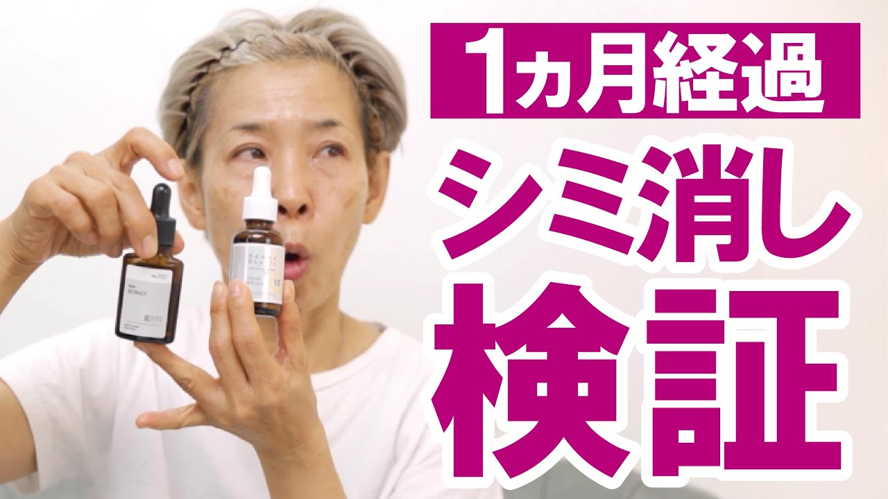 【シミが消えるか！3カ月検証】1カ月目の報告～