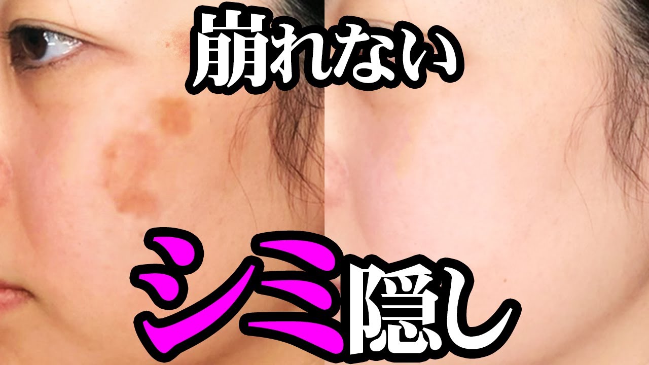 【シミ】カバー出来ても崩れる・・こんな悩みの解決方法