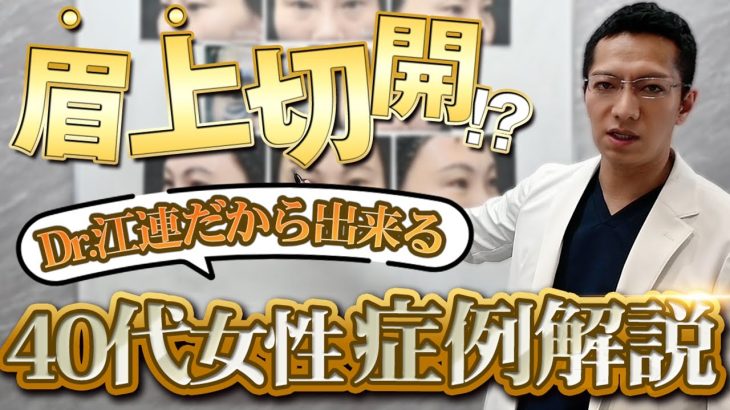 【若返り】40代女性の「LVS切開式眉上切開（ブローリフト）」の経過やダウンタイム、傷跡について解説【眉アートメイク / リジェネラ傷跡治療 / 裏ハムラ法】