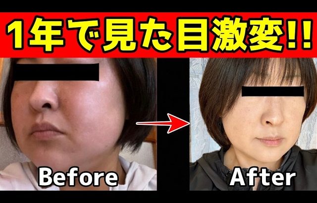 【1年で見た目激変✨】老け顔がどんどん若返る最強のセルフケアを紹介！顔のたるみやほうれい線を解消して若くて美しい顔になるエクササイズ
