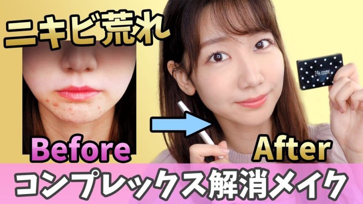 【初公開】ニキビ肌荒れを徹底的に隠すメイク術！