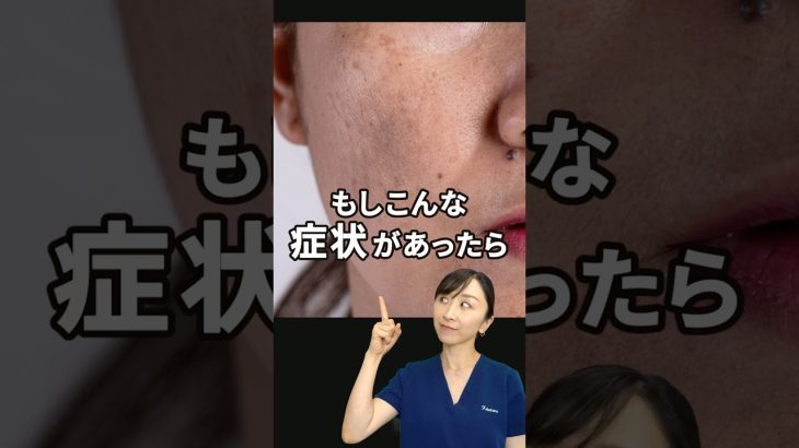 【肝斑】まず試すべき成分を皮膚科医が解説