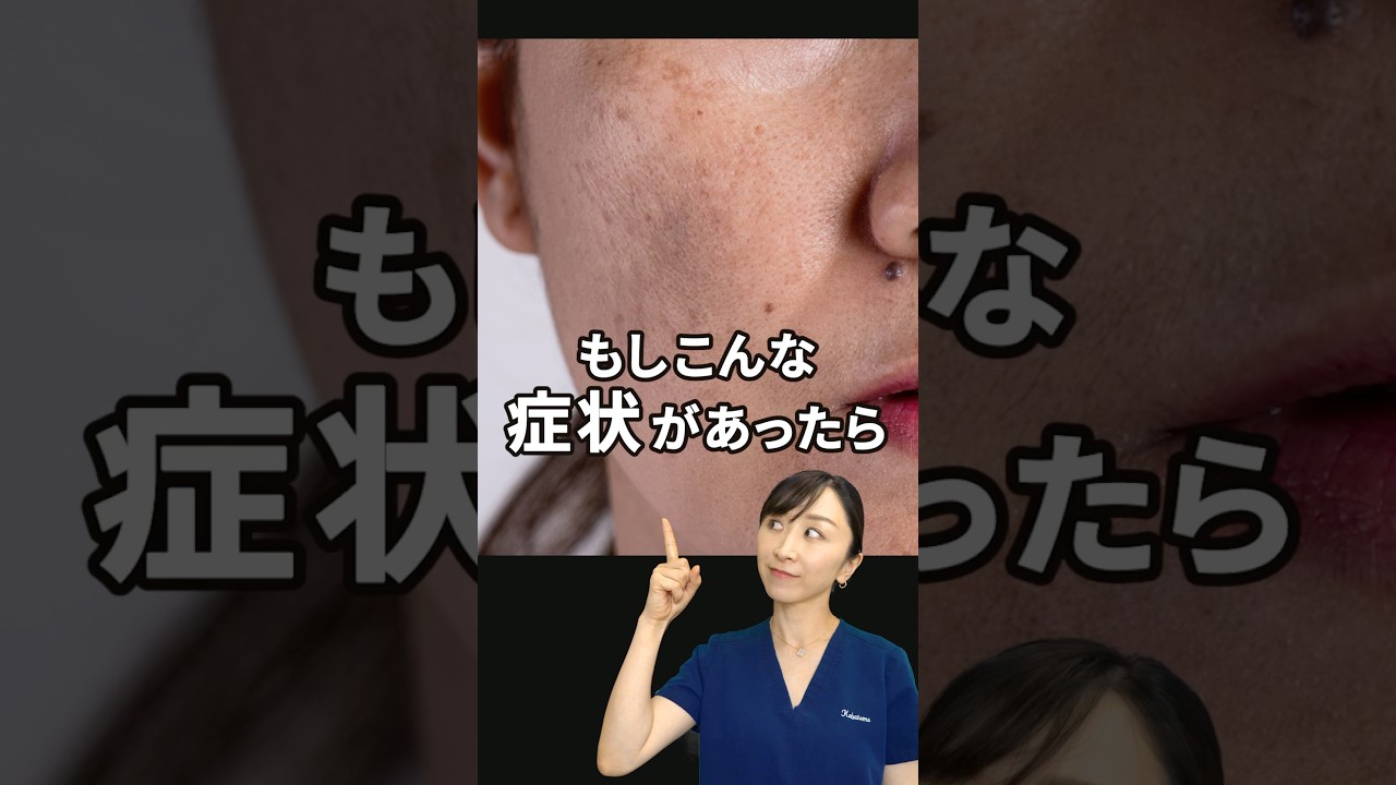 【肝斑】まず試すべき成分を皮膚科医が解説