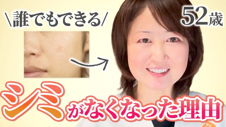 【最近老けた】シミが消える方法5選【40・50代必見】