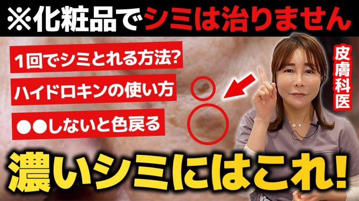 【医師が解説】40代以上の濃いシミも消す一番の方法はこれ！皮膚科医が教える人生を変える本気のシミ治療 |美容医療 | 肝斑| ハイドロキノン