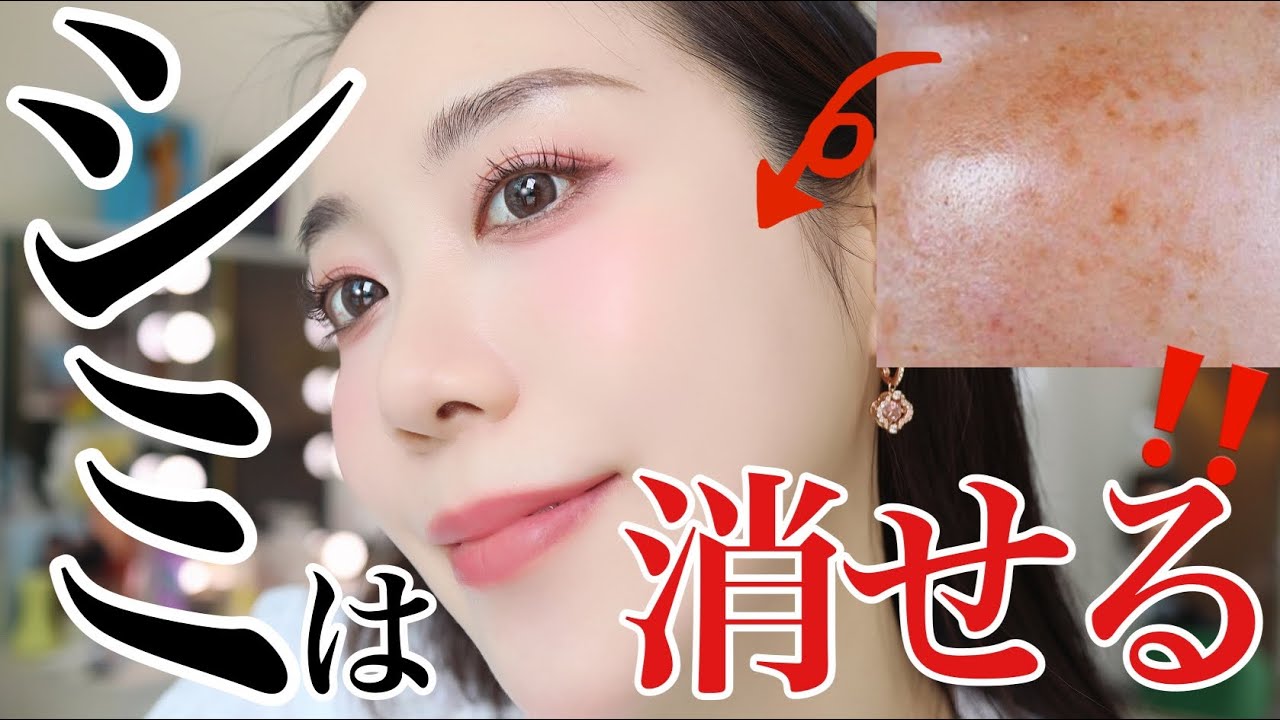 シミを消す方法🔥シミ取りレーザー効果なし⁉️スキンケアでシミをなくす方法✨
