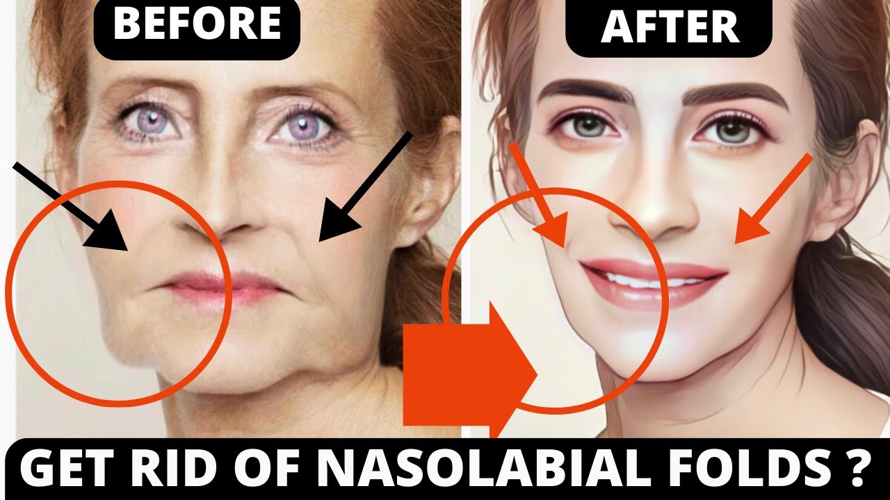 Erase Smile Lines Naturally | 16-Minute Face Lifting Exercises for Jowls & Saggy Skin