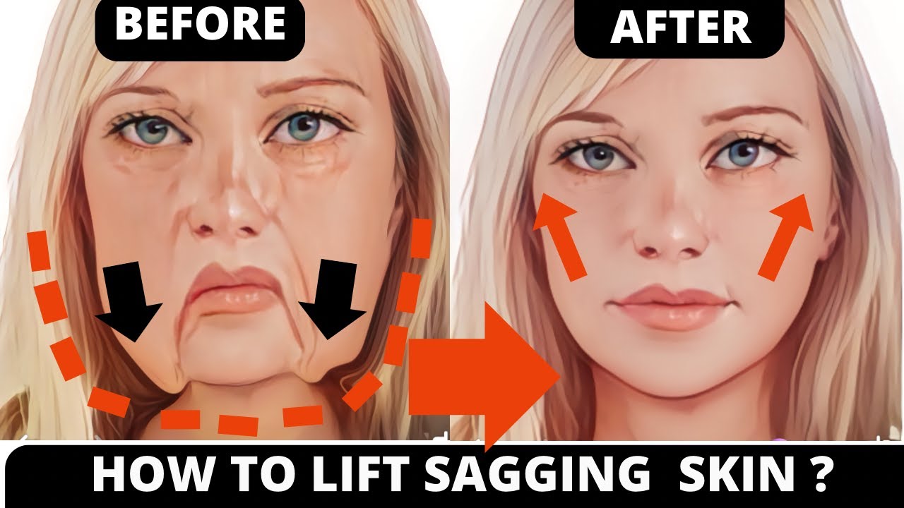 Face Lifting Exercises to Tighten Sagging Skin, Jowls & Cheeks! Face Yoga to Reduce Eye Bags