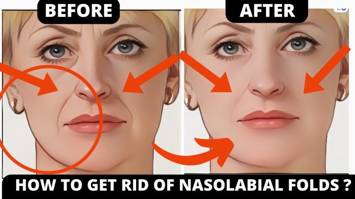 Face Yoga for Laugh Lines | Lift & Tone Nasolabial Folds