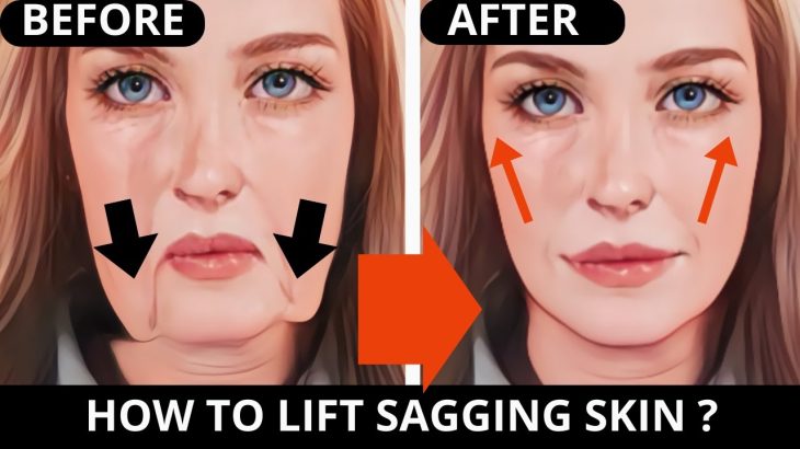 Over 35? 15 Min Face Lifting Exercises for Jowls & Saggy Skin! Remove Wrinkles & Laugh !