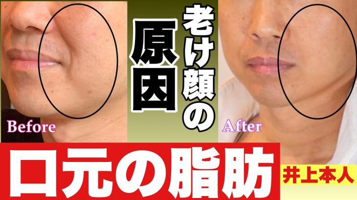 ほうれい線！顔のたるみの原因は『口元の脂肪を燃焼しろ』