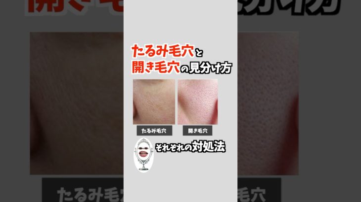 たるみ毛穴と開き毛穴の見分け方&対処法