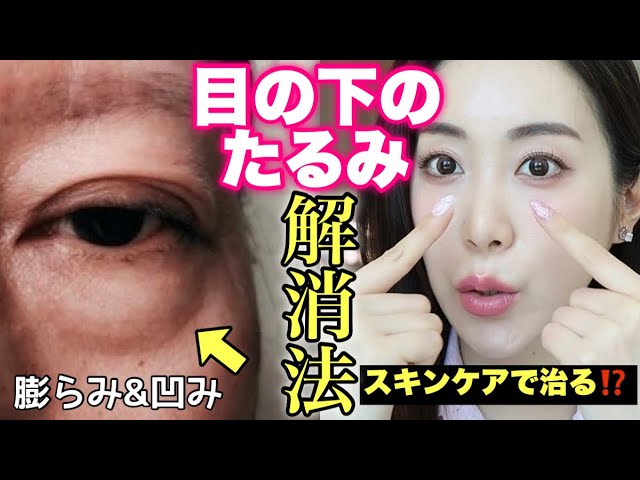 【目の下のたるみ】口コミ話題🔥スキンケアで解消できると噂のアイテムが史上最強に良かった‼️