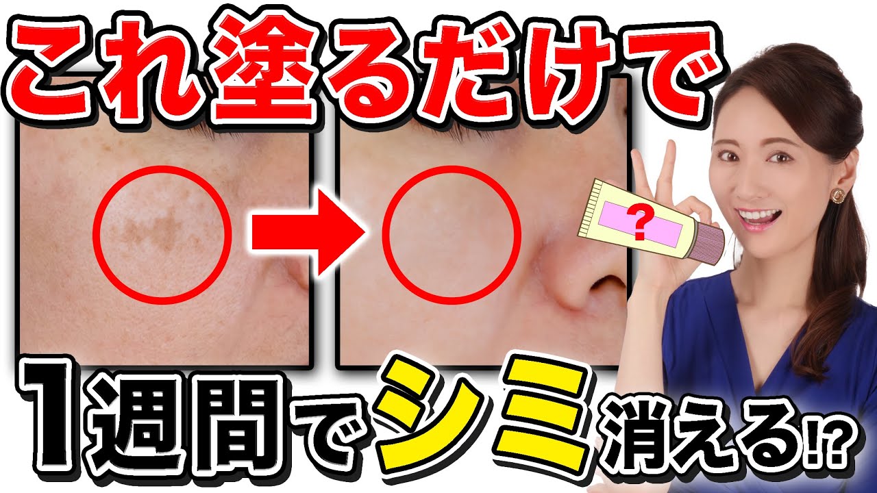 【塗るだけでシミ消える⁉︎】たった数千円のクリームでシミが1週間で消えた方法【エステ、シミ取り化粧品不要】