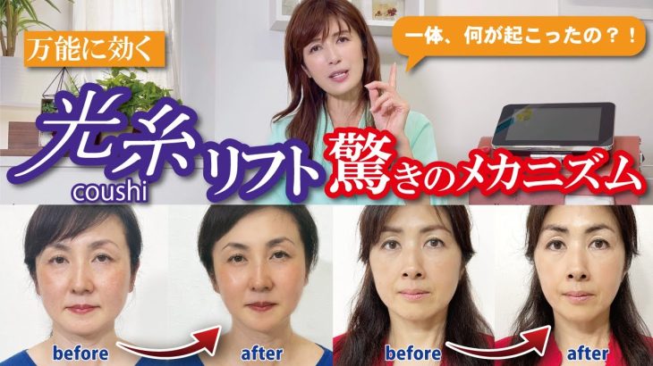 【最先端美容光糸リフト】メカニズムを徹底解説 20分でここまで変わる美容整形超えの大変身！
